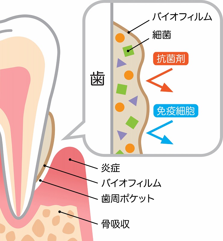 バイオフィルムとは